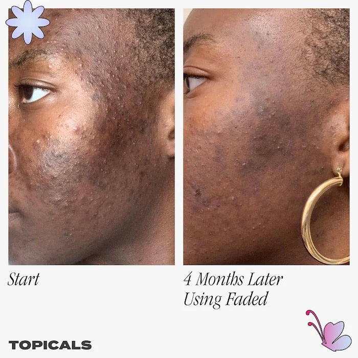 Topicals Faded Serum for Dark Spots &amp; Discoloration image 2