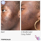 Topicals Faded Serum for Dark Spots &amp; Discoloration image 2
