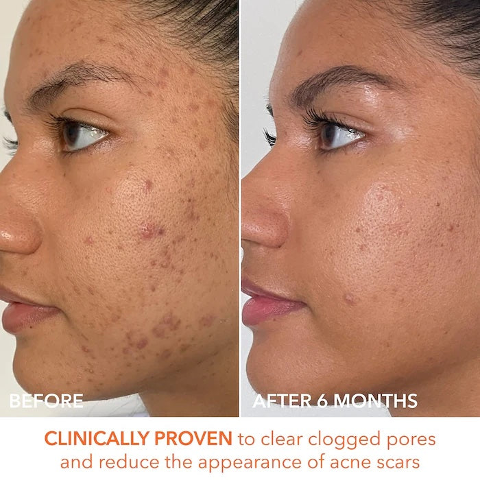 Dr. Dennis Gross Skincare Mini Alpha Beta® Extra Strength Daily Peel image 1