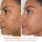 Dr. Dennis Gross Skincare Mini Alpha Beta® Extra Strength Daily Peel image 1