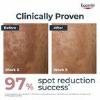Eucerin Anti-Pigment Dual Face Serum for Pigmentation &amp; Dark Spots with Thiamidol &amp; Hyaluronic Acid 30ml image 1