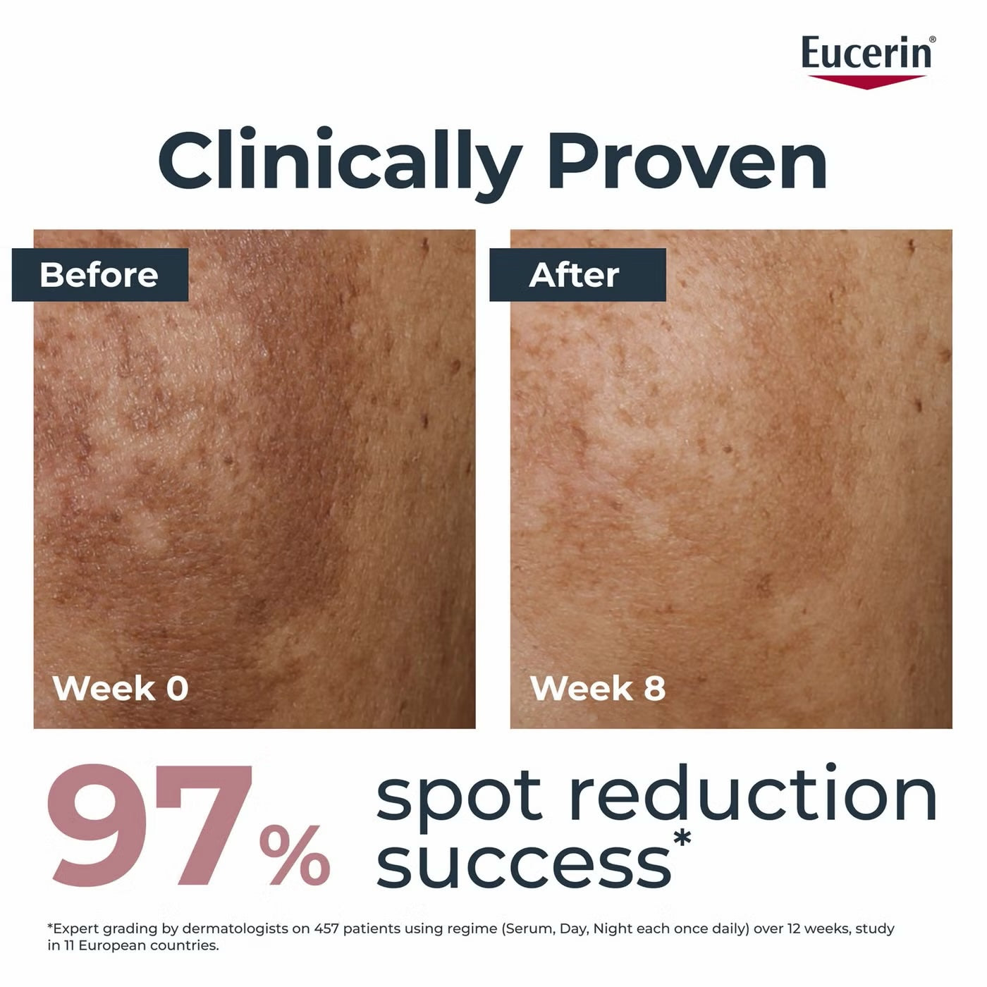 Eucerin Anti-Pigment Dual Face Serum for Pigmentation &amp; Dark Spots with Thiamidol &amp; Hyaluronic Acid 30ml image 1