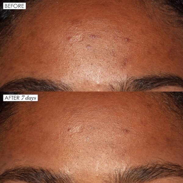 Sunday Riley Good Genes All-In-One AHA Lactic Acid Treatment - Image 3